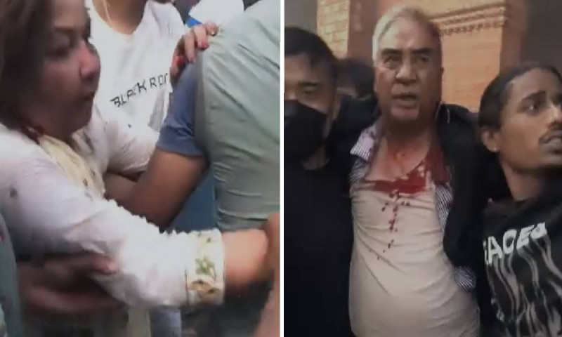 देउवाको टाउकोमा १२ टाँका, स्वास्थ्यमा सुधार हुँदै